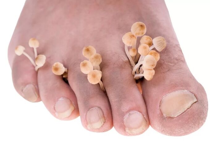 The navel of the feet