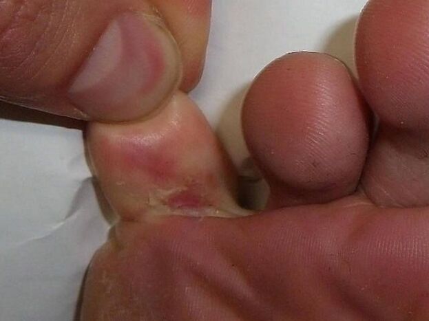 The effects of the mushroom on the skin