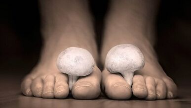 How to recognize the presence of fungi in the legs